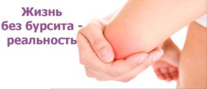 Бурсит локтевого сустава лечение в домашних условиях